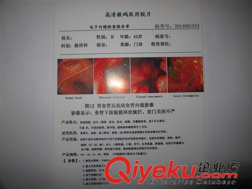 醫(yī)用膠片 A4亞光雙面打印PET醫(yī)用噴墨激光打印膠片 B超四維彩超胃腸鏡PET原始圖片2