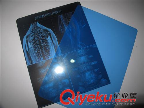醫(yī)用膠片 A3醫(yī)用藍(lán)片噴墨醫(yī)療片新型放射膠片CT、DR、X光膠片新型藍(lán)片